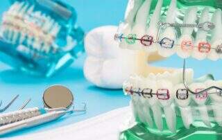 elastômeros odontologia